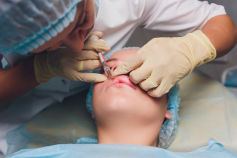 Cirugía Maxilofacial